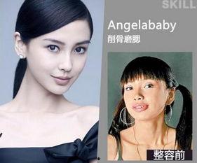 长沙整容爆料案件最新情况,真相大白,受害者权益如何保障?